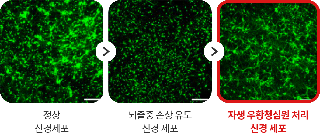 정상 신경세포-뇌졸중 손상 유도 신경세표 - 자생 우황청심원 처리 신경 세포