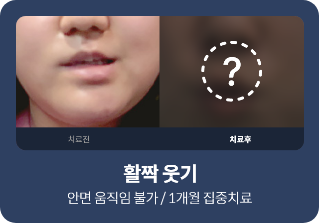 활짝 웃기 , 안면 움직임 불가 / 1개월 집중치료
