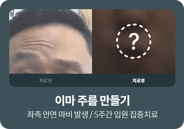 이마 주름 만들기 , 좌측 안면 마비 발생 / 5주간 입원 집중치료