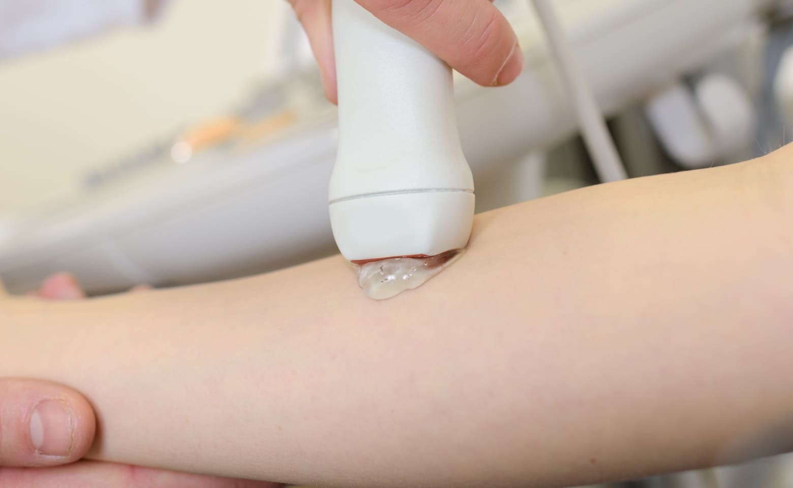 관절 초음파 검사