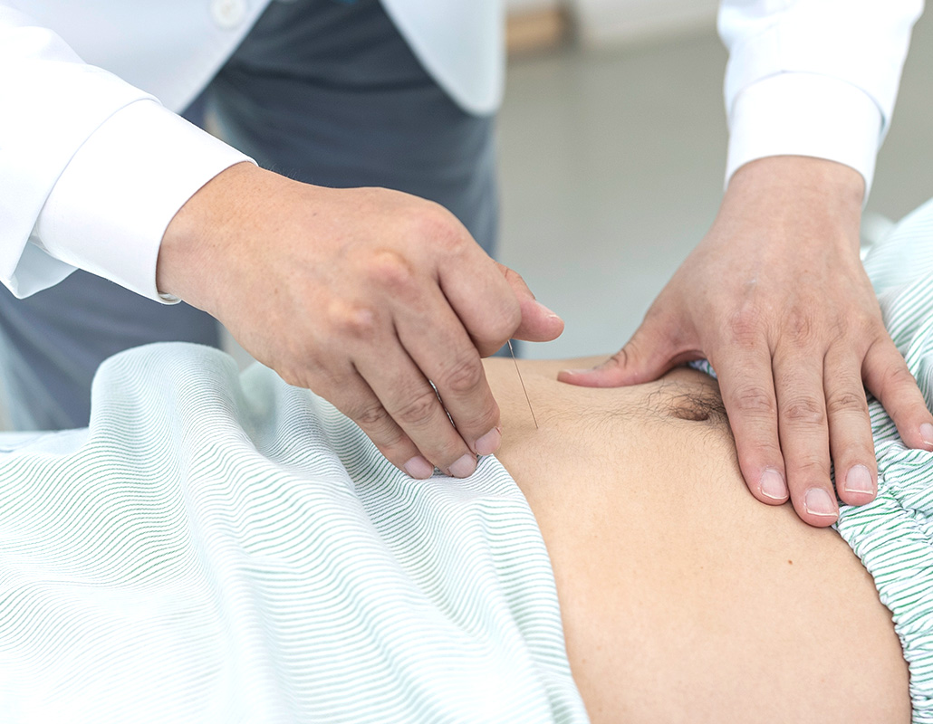 침 시술