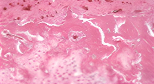 연골손상 유도 쥐 연골세포