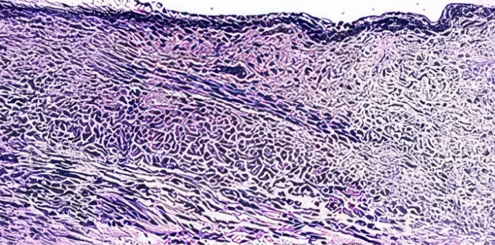 갱년기 유도 난소 절제군
