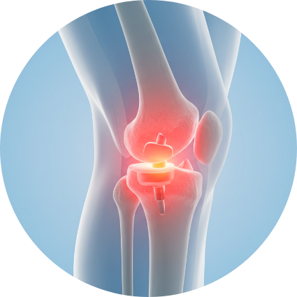 금속물 부작용 그래픽