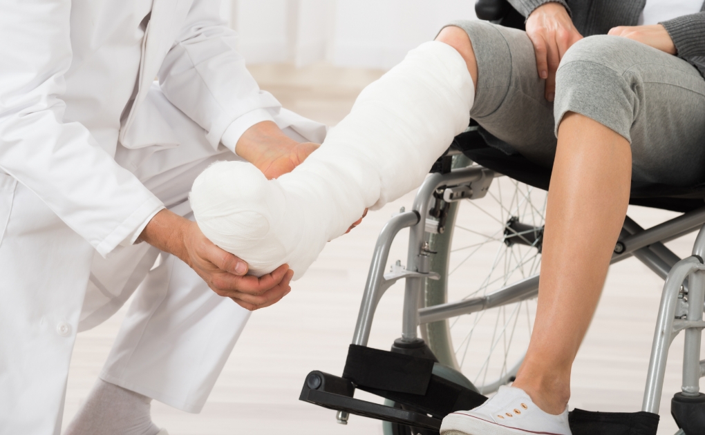 다리 재활 프로그램 중인 사람