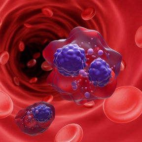 손상된 조직 부위가 붉게 강조된 관절 내부 3D 이미지